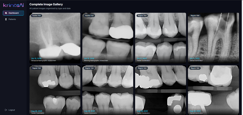 Real patient 2D radiographic scan taken in KrinosAI software