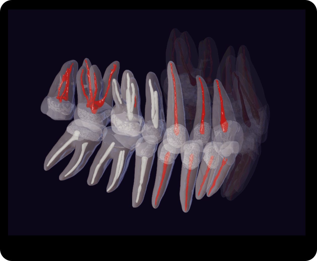 3D CBCT tooth and jaw segmentation model by Diagnocat standard